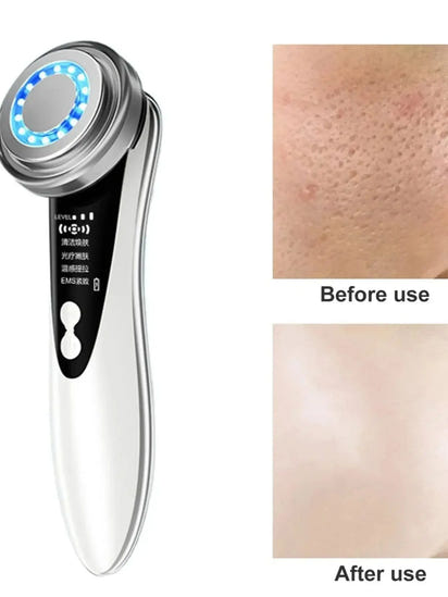 Radiance Revive Facial Massager™